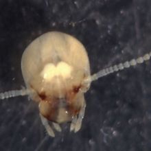 A photo of a termite’s head with its brain clearly visible