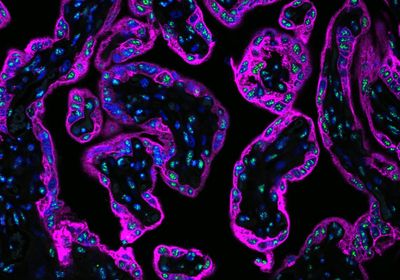 Immunofluorescence image of a cross-section of a term placenta showing STB and CTB labeled pink and surrounding nuclei and nuclear speckles labeled blue and green, respectively.