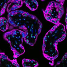 Immunofluorescence image of a cross-section of a term placenta showing STB and CTB labeled pink and surrounding nuclei and nuclear speckles labeled blue and green, respectively.&nbsp;