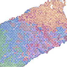 Image of spatial transcriptomic spots superimposed onto a stained tissue section.