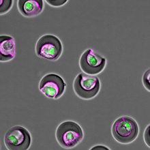 A micrograph shows grey sickle-shaped nanovials containing single, fluorescent green mesenchymal stem cells. Some of the cells have secreted high levels of magenta-colored extracellular vesicles.