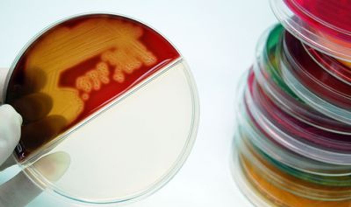 A researcher examines Petri dishes containing bacterial colonies growing in different types of culture media.