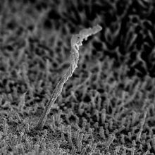 An antenna-like cellular structure emerges from the surface of a human pancreatic islet cell. The surface of the cell is covered with small structures called microvilli.