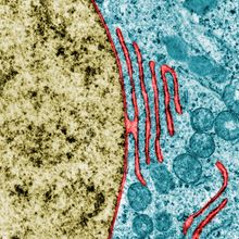 A false color transmission electron microscope micrograph showing the nuclear envelope, the rough endoplasmic reticulum, the nucleus, and the cytoplasm.