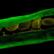 A close-up image of pale green seeds inside of a green capsule taken by a scanning electron microscope