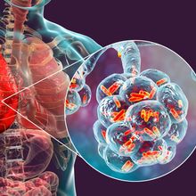 Translucent, red-orange organs are shown inside a person’s transparent, blue torso. One region zooms in on blue lung alveoli covered by bright orange microbes.