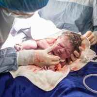 a newborn C-section baby in the gloved hands of doctors