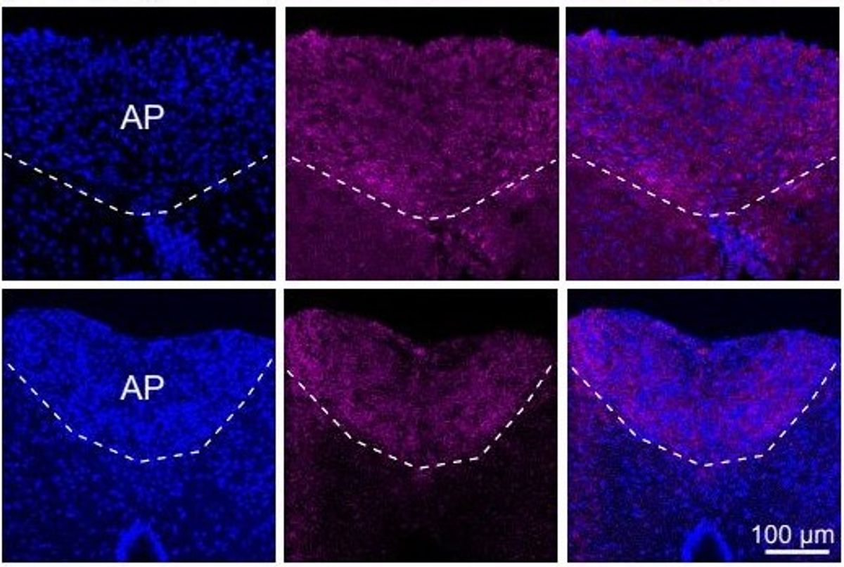 Interleukin-6, a multi-function molecule associated with cachexia, is visualized in the brain of healthy and cachectic mice. 