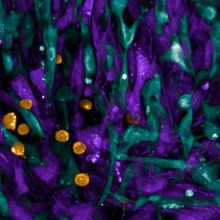 A microscopy image stained for different cell populations in breast tumors.