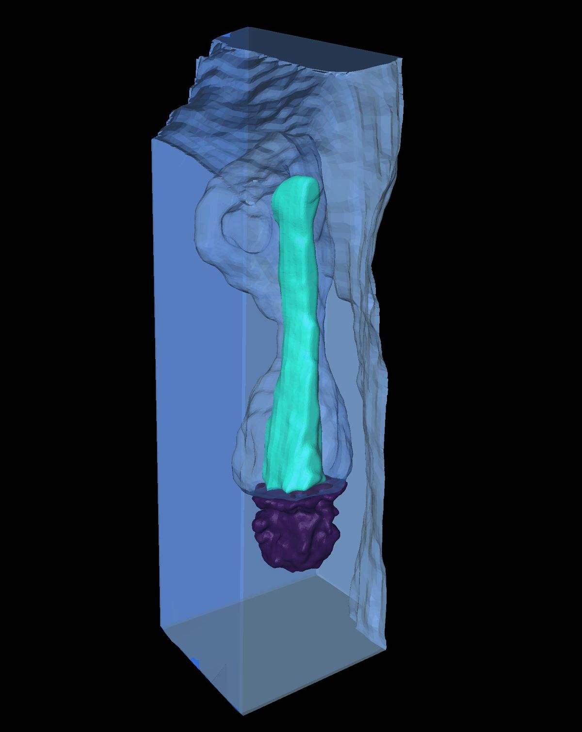 A 3D reconstructed image of a cyan primary cilium concealed within a clear membranous compartment and attached to a purple mother centriole.