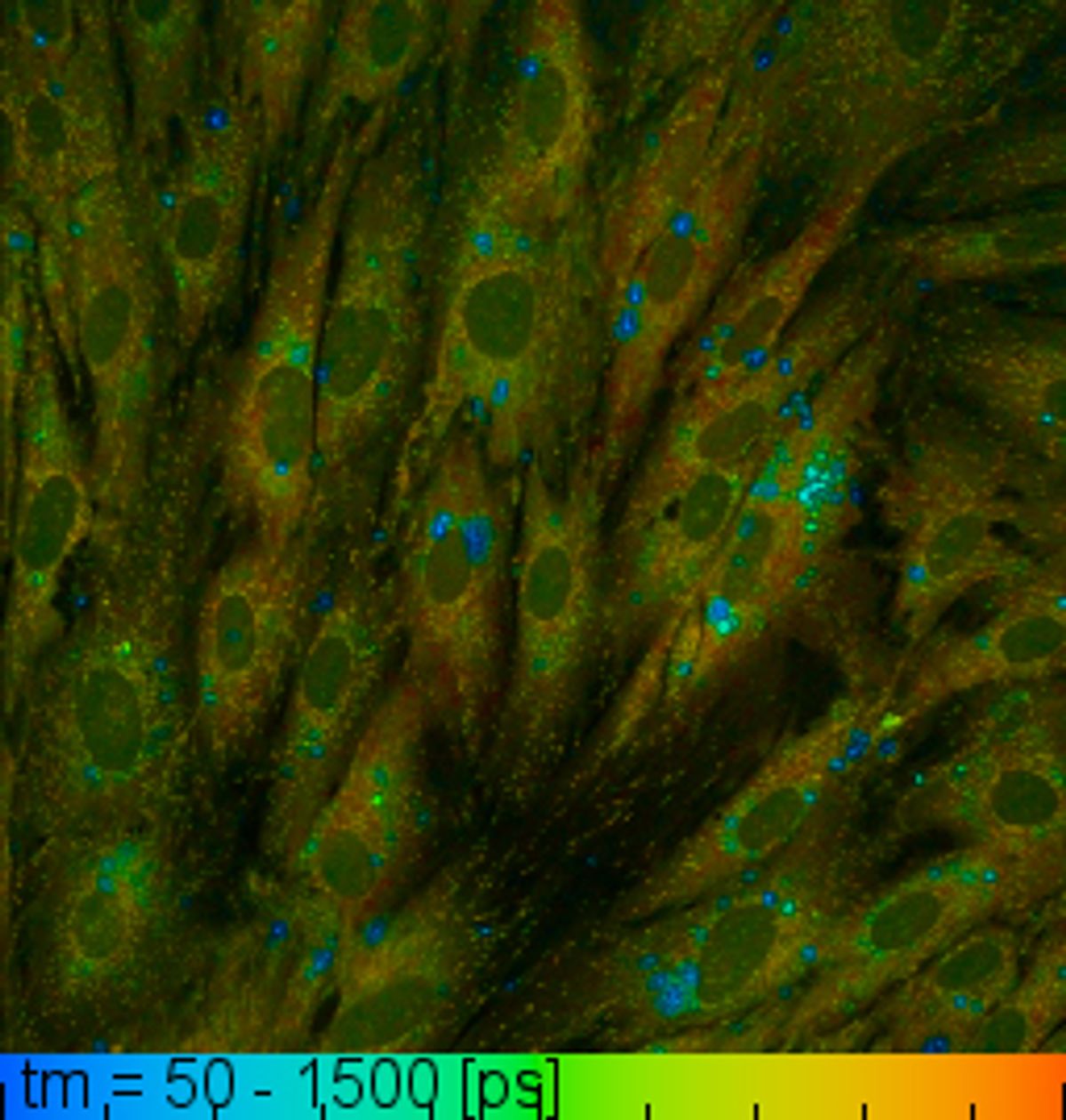 Fluorescent image of spindle-shaped cells infected with parasites where a color gradient from blue to red indicates the concentration of the metabolites NAD(P)H.