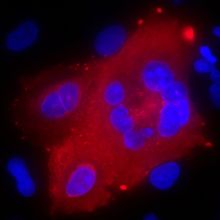 Microscope image of A549-ACE2 lung cells coinfected with SARS-CoV-2 and a reporter vector containing a key regulatory variant of interest in the region on human chromosome 3