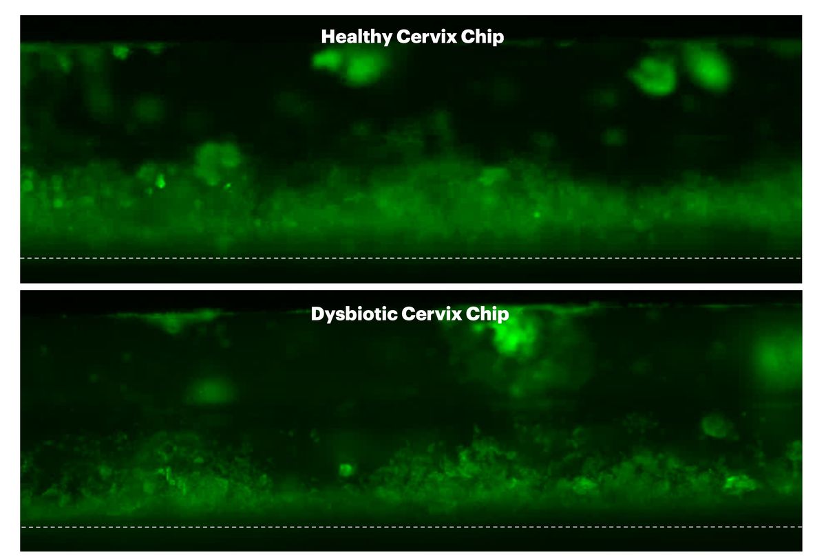 Two images showing a green-colored layer against a black background. The green layer in the top image is thicker than that in the bottom one.