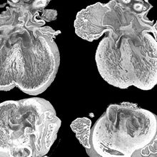 The heart sections on the left present defects while the hearts on the right do not show defects.&nbsp;