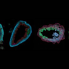 Cross sections of a mouse colon, where RNAs are colored depending on the local expression profile. &nbsp;