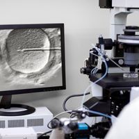 photo of a researcher looking in a microscope fertilising an egg via intracytoplasmic sperm injection.