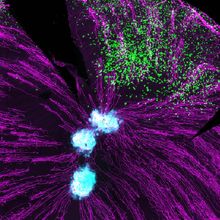 Microscopic image of nerves in the eye, a pathogen, and t cells