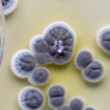 Bluish-grey circles of fuzzy mold grow in a Petri dish.