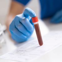 A vial containing a red blood sample is balanced on its end on a table or desk by someone wearing a blue medical glove on their right hand