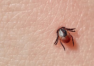 A tick embedded into skin.&nbsp;