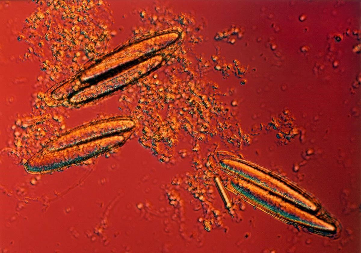 Three dividing <em >Epulopiscium viviparus</em> cells seen on a microscope.