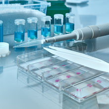 Discover how biobanking accelerates cancer research