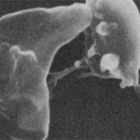 archaea fused together with cytoplasmic bridges