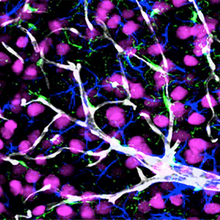 Histology of brain