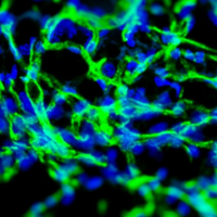 blood vessel hydrogel microvasculature endothelium