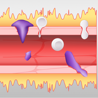 bradykinin kinin cascade ras covid-19 sars-cov-2 dabk cytokines macrophage edema fluid lung leaky blood vessel