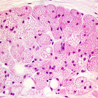 brown fat, metabolism, cardiovascular disease, cardiometabolic disease, genetics & genomics, immunology, Q&A, adipose tissue, obesity 