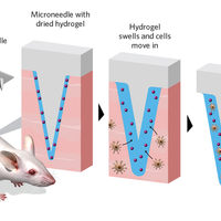 MO infographic the scientist microneedle patch