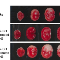 stroke, animal model, mouse model, blood, cytokine storm, immune system, immune response, MMP-9, neutrophil